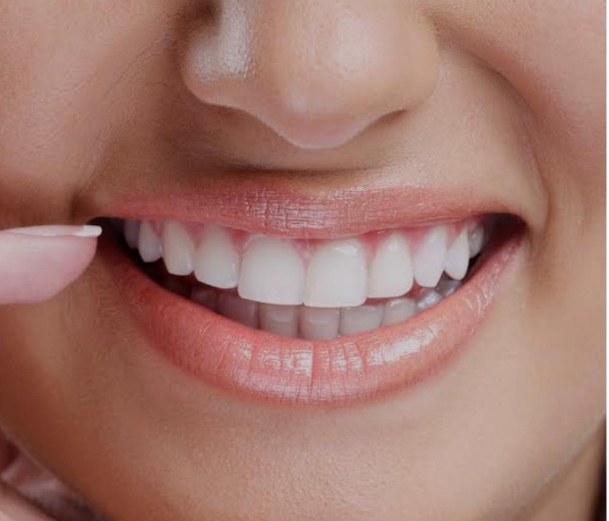 Dental Health: How to Keep Your White Smile Forever